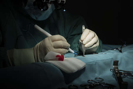 Female surgeon performs a micro-surgery operation on one armの写真素材