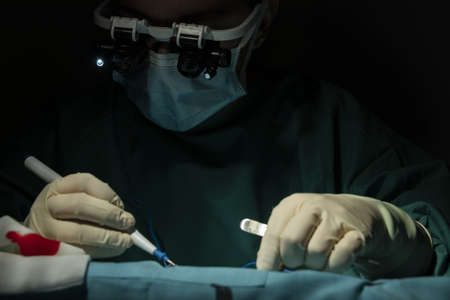 performance of single-stremity microsurgery by a female traumatologist-surgeonの写真素材