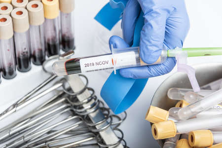 Scientists hand holding a test-tube with blood sample for NCOV19 test.の写真素材