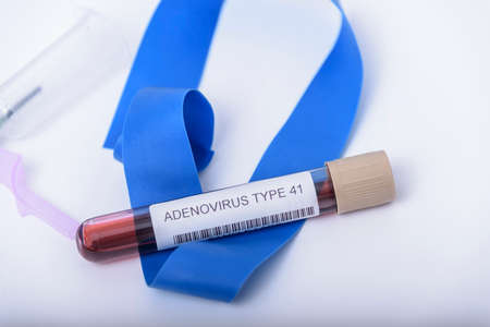 Childhood hepatitis. Blood sample tube for Adenovirus and Norovirus DNA PCR test at medical laboratory. To diagnosis viral infection.の写真素材
