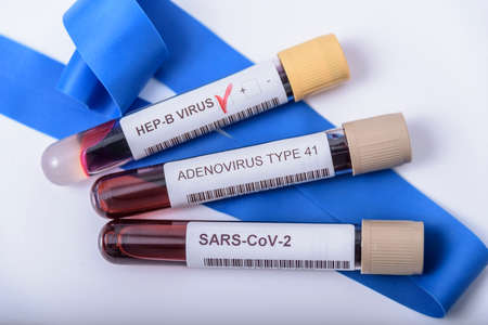Suspected adenovirus as a culprit in childhood hepatitis of unknown origin. Hepatic, sars-cov2.の写真素材