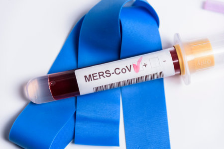 Close-up of laboratory sample positive for MERS-CoV infection.の写真素材