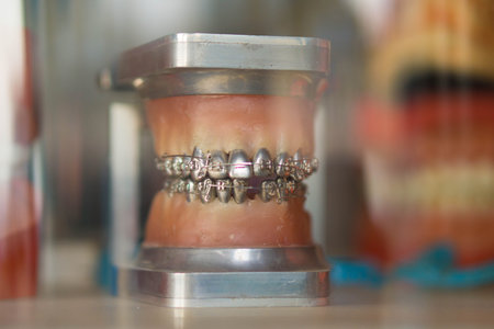 Denture set in showcase In the old house