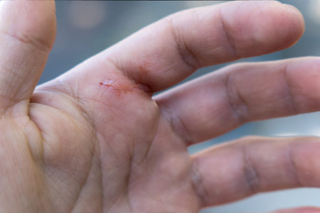 A Hand fingers with accidental cut at home, with space for textの写真素材