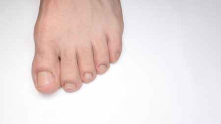 A Close of a person left foot toes with white background and space for text