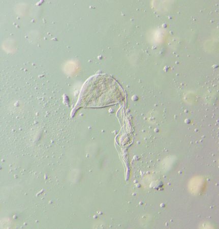 Nematode, a microscopic "worm" which causes plant diseases.の写真素材