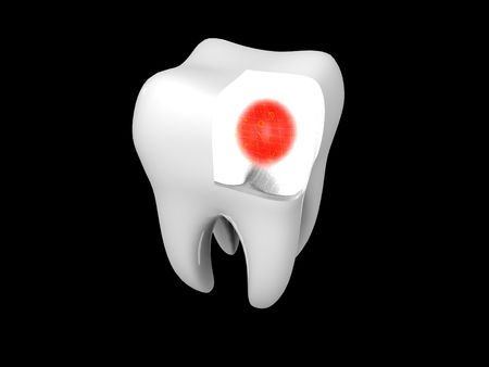 3D cartoon illustrating toothache with a red haloの写真素材