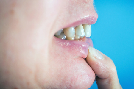 Close up of womanâs teeth in dental clinicの写真素材
