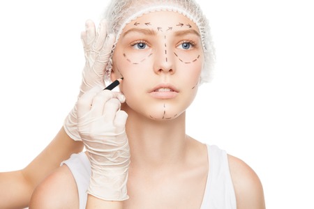 Portrait of young woman with plastic surgery outlines on faceの写真素材