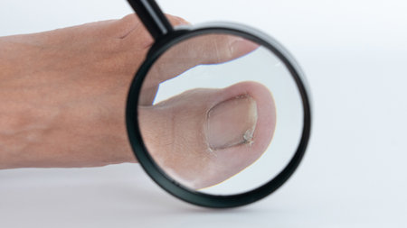 Close-up of a foot under a magnifying glass, emphasizing the toenail and its condition, illustrating the importance of foot health and careの写真素材