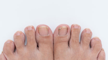 Close-up view of bare feet with unpolished toenails on a white background, highlighting natural foot care and hygiene in everyday lifeの写真素材