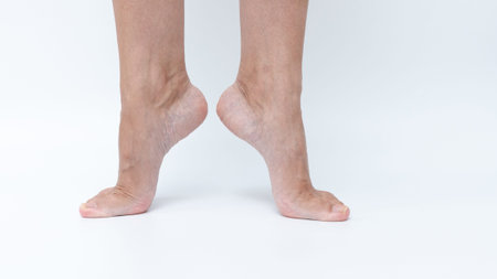 Varicose veins and spider veins on legs are shown in a clinical environment, emphasizing treatment...