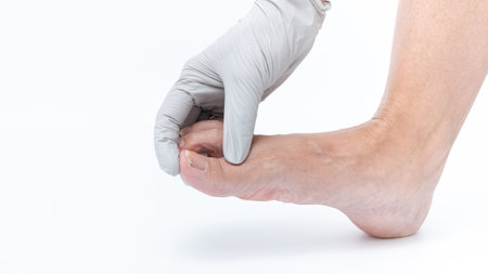 Hand applying gentle pressure to a sore foot, highlighting relief techniques for tired legs and feet, promoting wellness and relaxation in self-careの写真素材