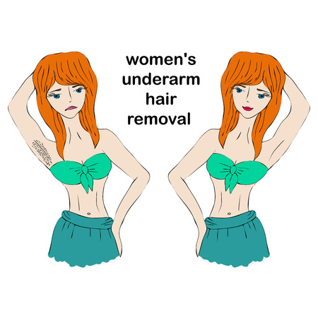 Cartoon beauty woman do epilation before and after. Concept of women's underarm hair removal.のイラスト素材