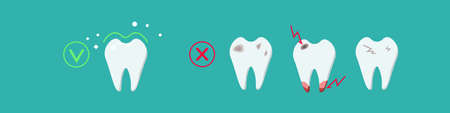Sick, destroyed teeth: dental plaque, caries, chips, and cracks and healthy clean teeth. Dental care for teeth. Vector illustration in a flat style isolated on a blue backgroundのイラスト素材