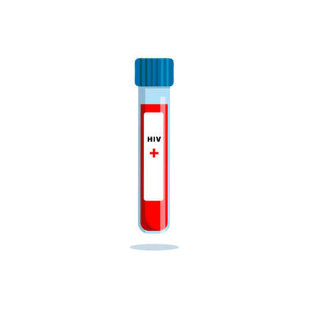 A test tube with a blood sample. Positive HIV test. Medical examination for human immunodeficiency virus. World day of fight against AIDS. Flat vector illustration isolated on a white backgroundのイラスト素材