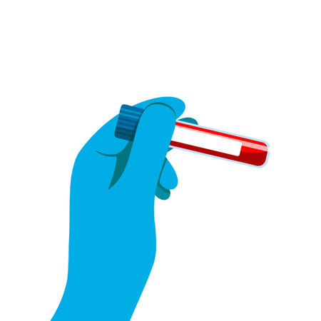 Blood in a test tube in the doctors hand. A blood sample in a test tube for analysis. Flat vector illustration isolated on white backgroundのイラスト素材