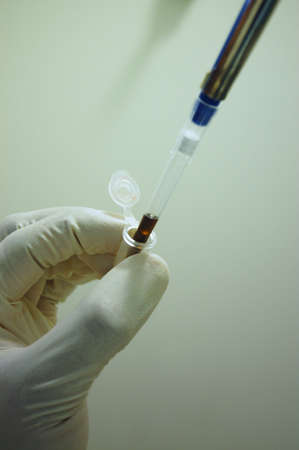 Close-up of scientist working with pipette and tubeの写真素材