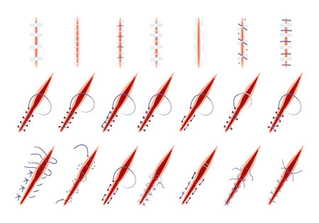 Suture icons set cartoon vector. Wound surgical. Doctor lacerationのイラスト素材