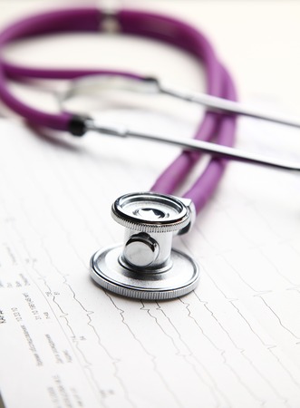 Stethoscope with cardiogram lying on desk in hospital.の写真素材