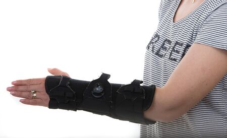 Woman with left hand orthosis isolated onw hite backgroundの写真素材