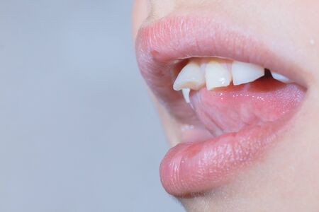 Baby tooth, close-up of the tooth that falls macro shot.の写真素材