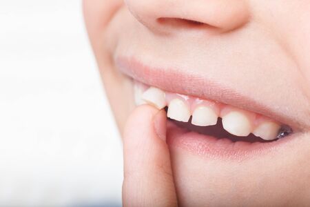 Baby tooth, close-up of the tooth that falls macro shot.の写真素材