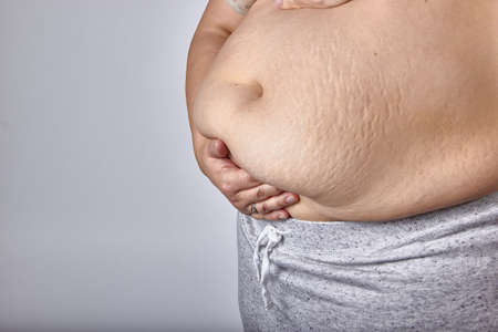 female belly after childbirth, excess fat and stretched skin.の写真素材