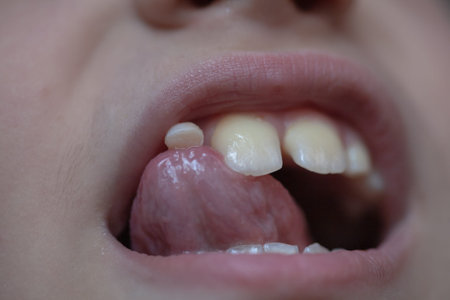 loss of a baby tooth in an eight-year-old child, at the last stage