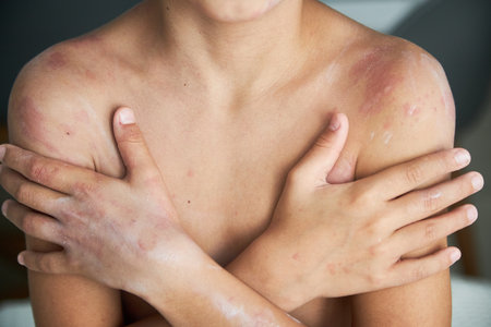 food allergy. a boy with red spots. The child has itching, with an allergic rash..の写真素材