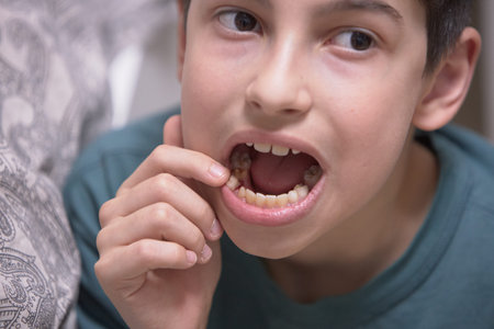 A boys tooth falls out of his mouth in close-up