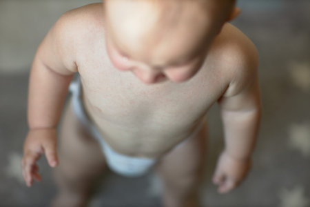 Roseola is the beginning of the course of the disease in the baby, there are barely noticeable spots...