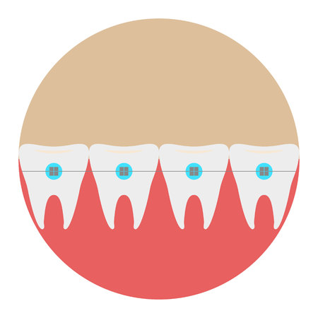 Teeth with braces icon dentist flat vector with long shadow sign. Symbol for mobile user.のイラスト素材