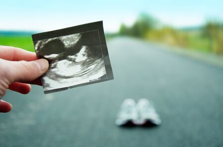 Running in pregnancy. Ultrasound image of unborn child with running shoes and road in the...