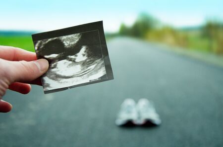 Running in pregnancy. Ultrasound image of unborn child with running shoes and road in the background.の写真素材