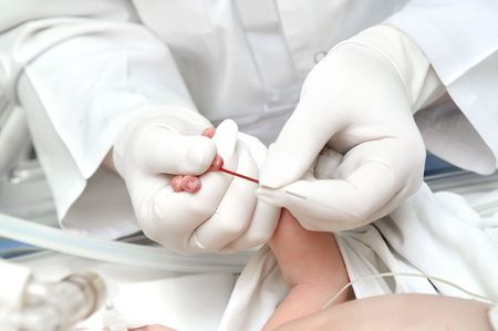 making medicine blood sampling from finger of newborn child in infant incubatorの写真素材