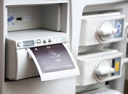 receiving an image from medical ultrasound system equipmentの写真素材