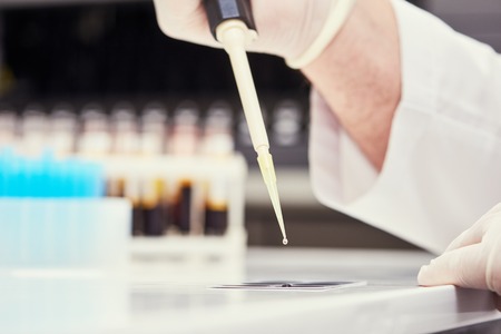 clinic medical test. hand with dropper of blood sample in laboratoryの写真素材