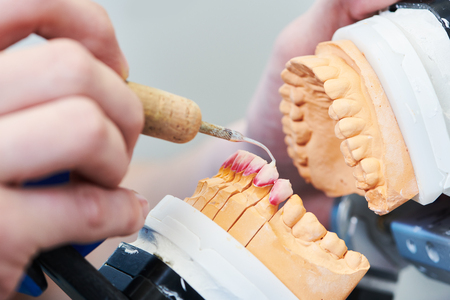 dental technician or prosthesis work. prosthetic dentistry processの写真素材
