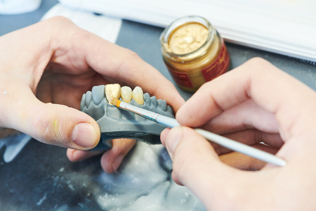 dental prosthesis work. Painting teeth