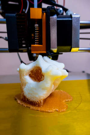 printing vertebrae on a 3d printer. artificial body parts printed on a 3d printer. New era of...