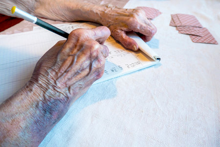 A bruise after an unsuccessful fall on the hands of an elderly man. Old age. wrinkled skin. an elderly woman with bruises on her hands is playing cards, keeping score. write the score in a card gameの写真素材
