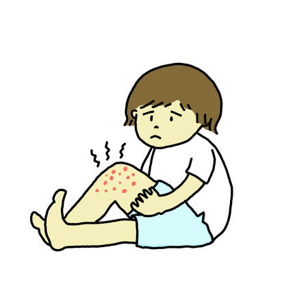 Woman with eczema on her legのイラスト素材