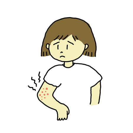 Woman with eczema on her armのイラスト素材