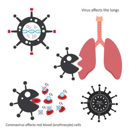 Vector medicinal illustration concept. Coronavirus Covid -19 affects parts of human organismのイラスト素材