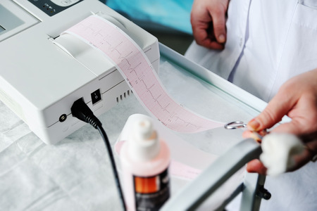 Electrocardiogram, ecg in hand. Clinic cardiology heart rhythm and pulse test closeup. Cardiogram...