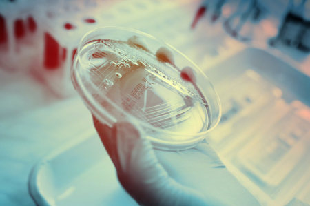 Petri dishes in the bacteriological laboratory closeupの写真素材
