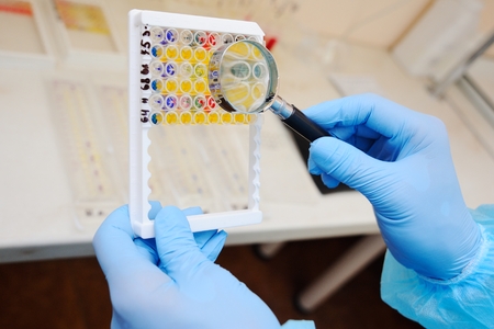 a laboratory assistant or a scientist examines through a magnifying glass bacterial tests against...