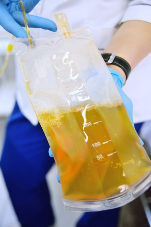 plasma in a plastic bag in the hands of a nurseの写真素材
