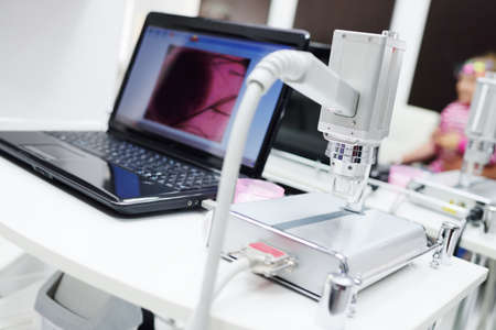 Image of a birthmark or warts close-up on a laptop monitor. Dermatology, dermatoscopy, prevention of melanoma, skin cancer.の写真素材